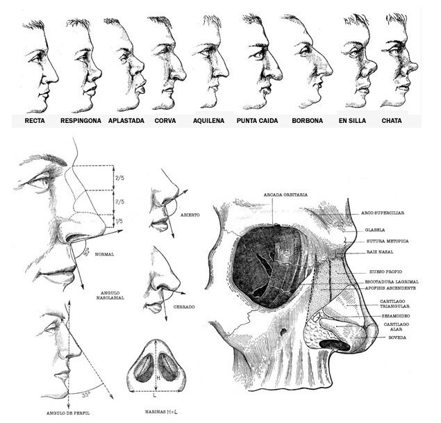 Rinoplastia